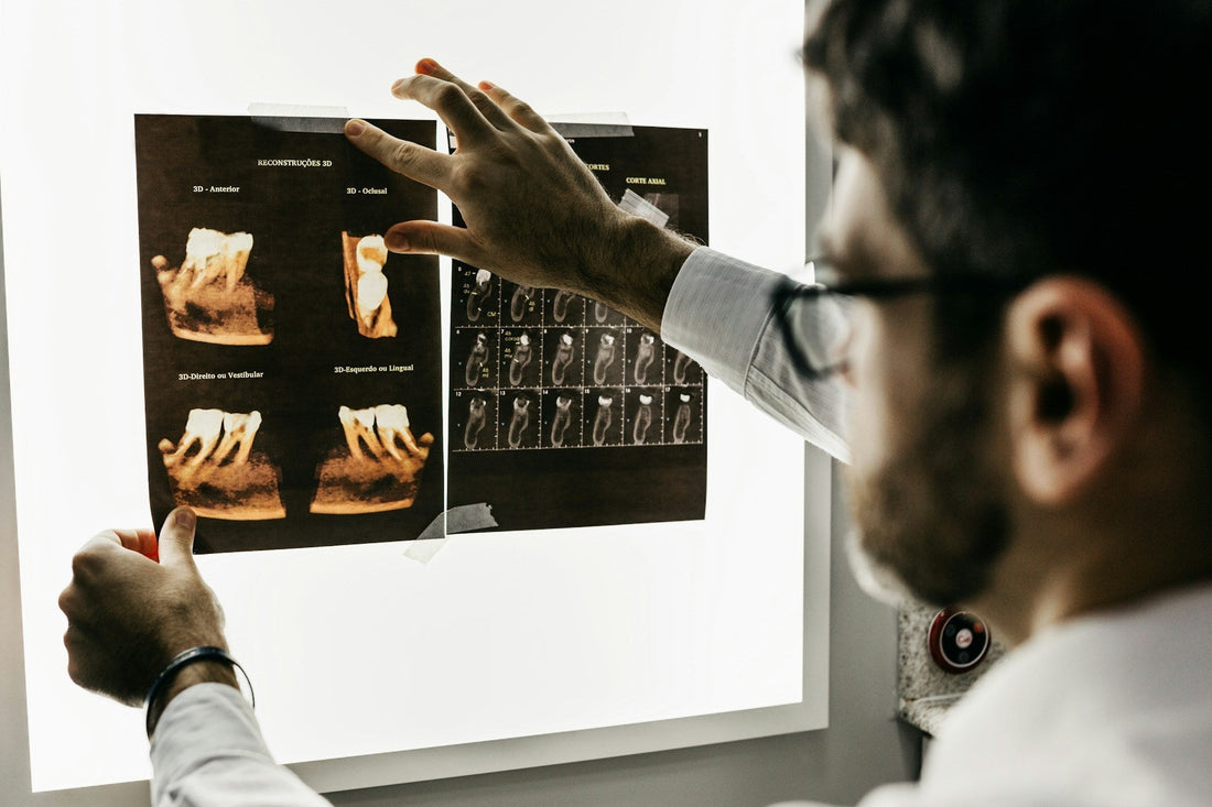 Dentist reviewing 3D dental X-rays, emphasizing the importance of professional care and technology in maintaining oral health.