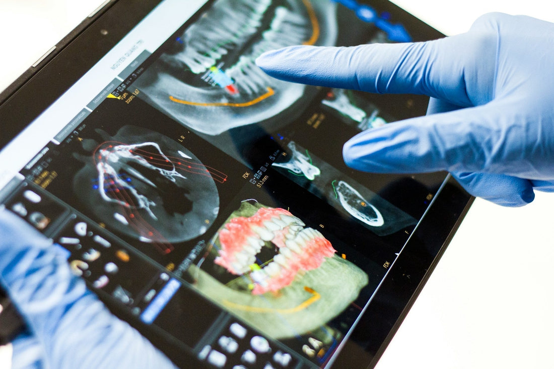 Dentist using a tablet to review detailed dental X-rays, showcasing advanced diagnostic technology in oral health care.