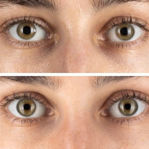 Haloral LED Light Therapy Face Mask