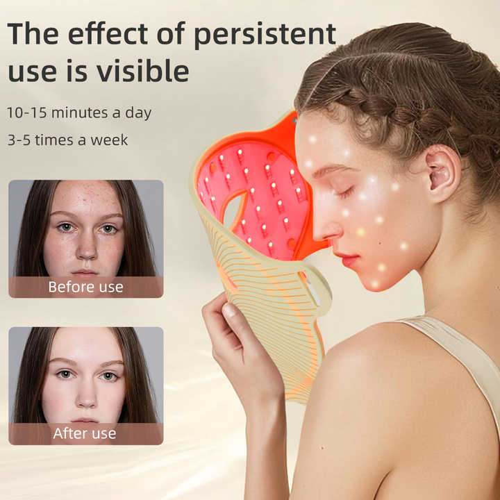 LED Light Mask for Acne Treatment