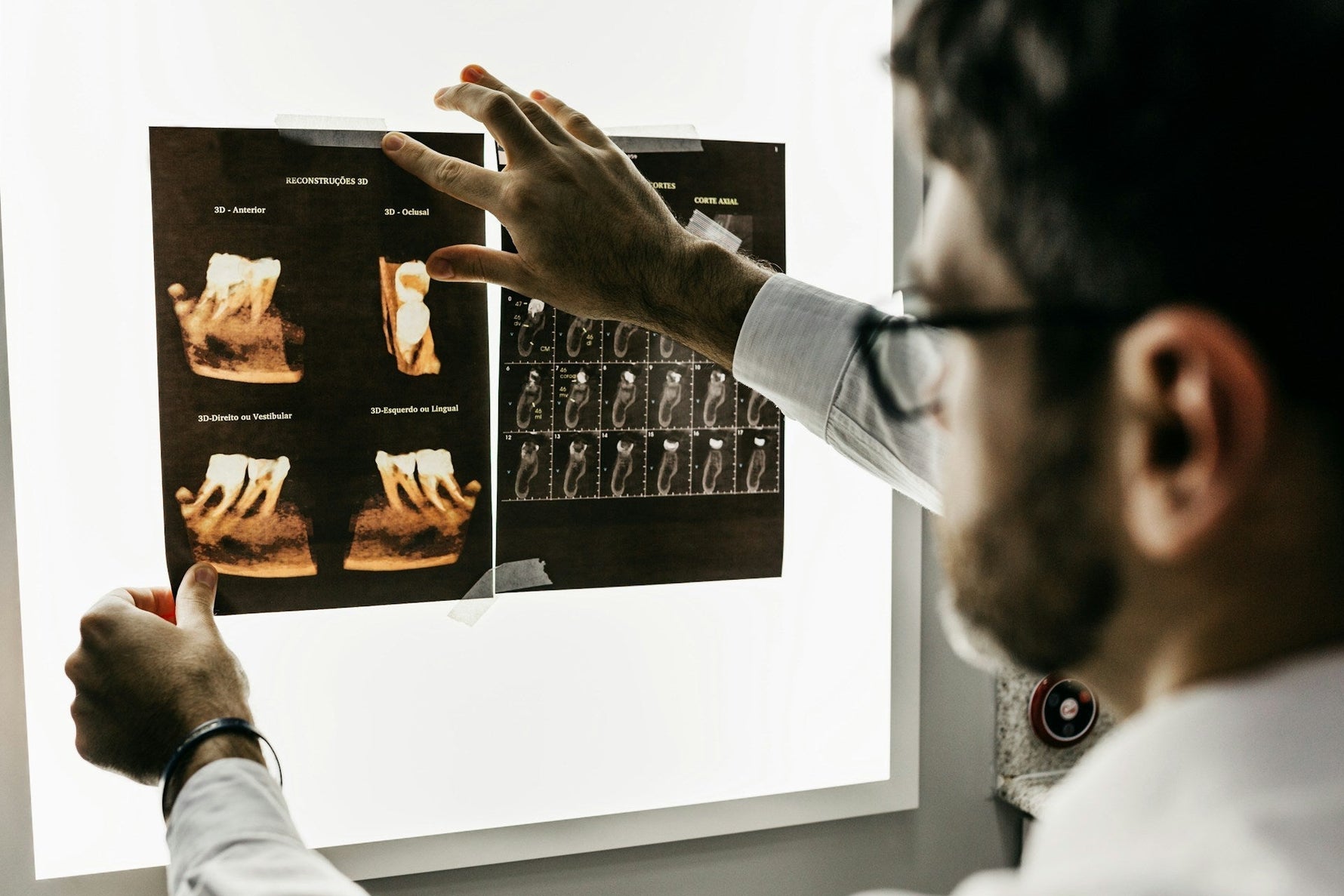 Dentist reviewing 3D dental X-rays, emphasizing the importance of professional care and technology in maintaining oral health.