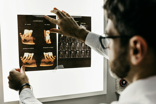 Dentist reviewing 3D dental X-rays, emphasizing the importance of professional care and technology in maintaining oral health.