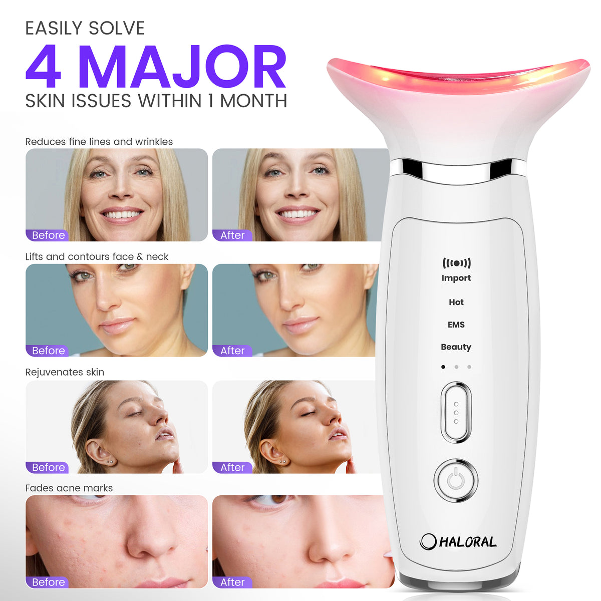 Haloral EMS Face & Neck Lifting Anti-Aging Device