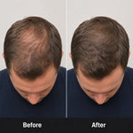 Before and after comparison showing fuller-looking crown hair results for men using red light therapy scalp care